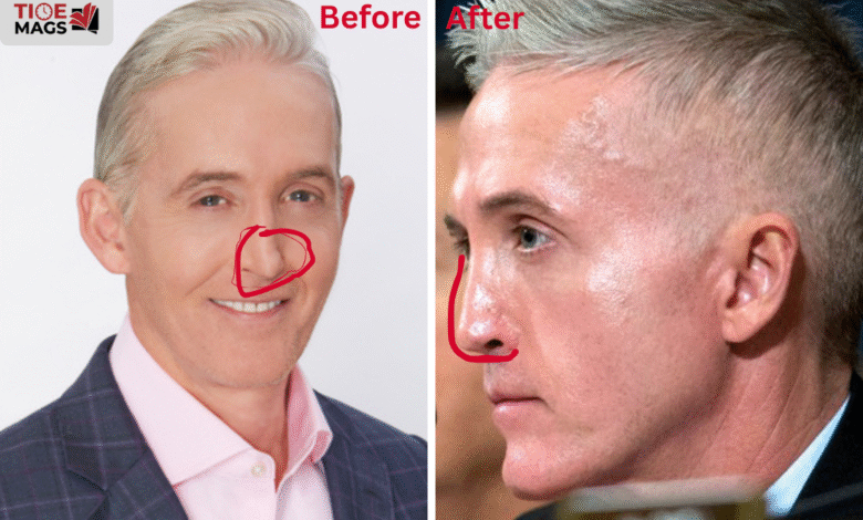 trey gowdy plastic surgery