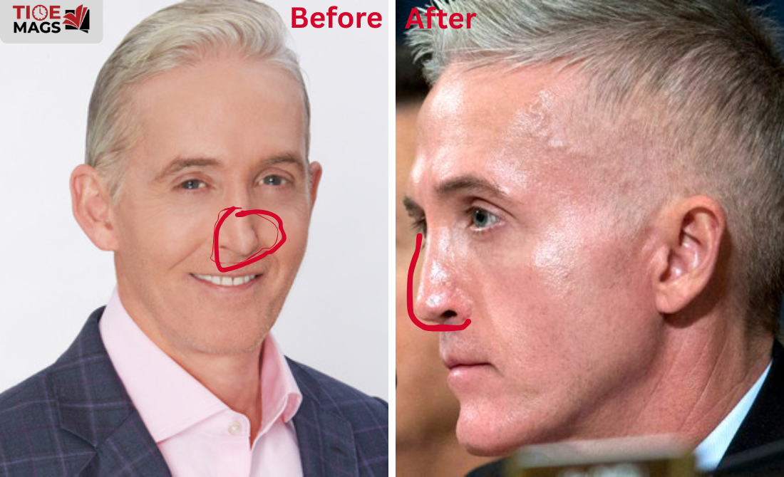 trey gowdy plastic surgery trey gowdy plastic surgery