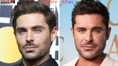 Zac Efron Before and After