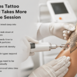 7 Reasons Tattoo Removal Takes More Than One Session